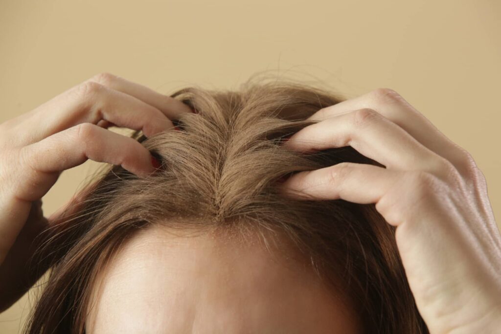 Trockenshampoo hilft dabei, mehr Standfestigkeit am Haaransatz zu schaffen